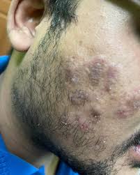 Masalah hormon bukan hanya pada pelajar perempuan?