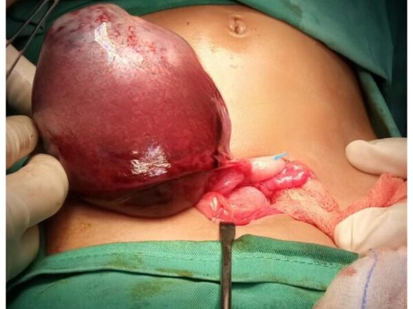 Kenapa Hormon Wanita Zaman Sekarang ‘Huru-Hara’?