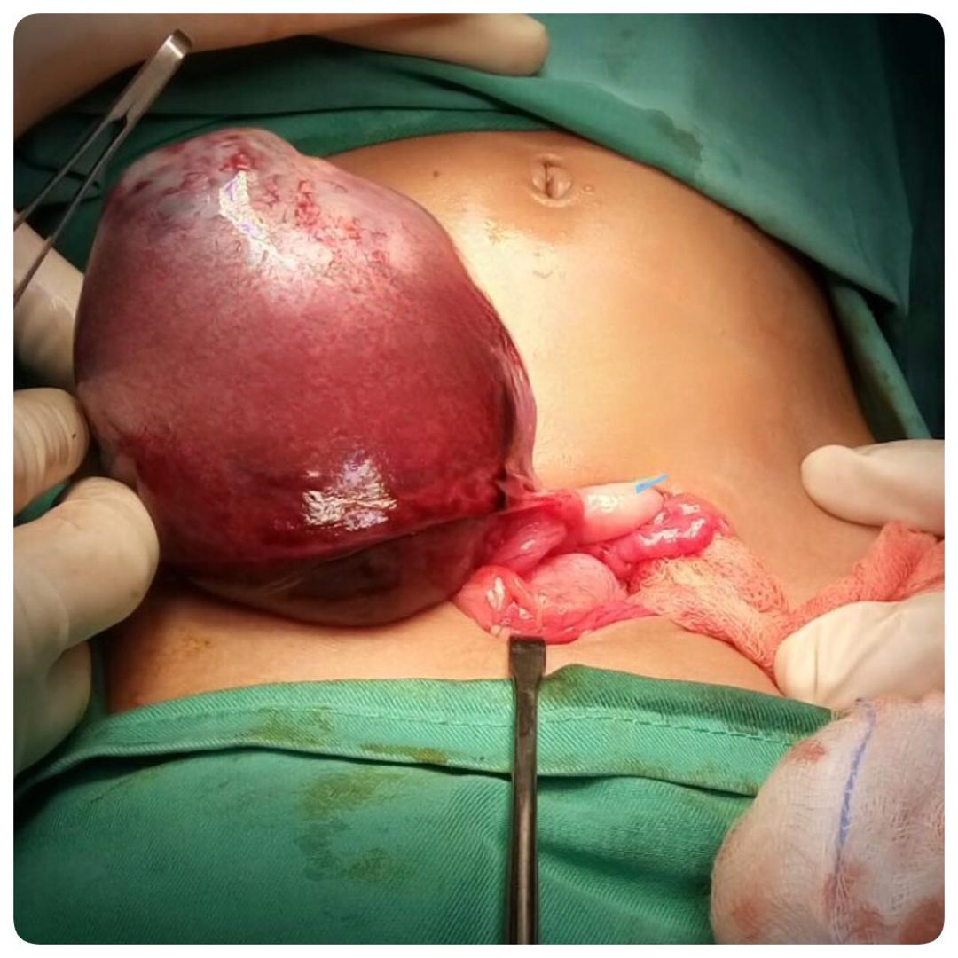 Kenapa Hormon Wanita Zaman Sekarang ‘Huru-Hara’?