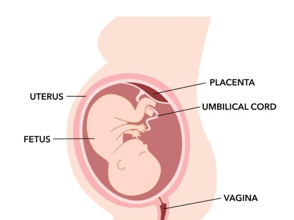 Kandungan 3 bulan tapi ada cyst , apa perlu ibu lakukan?