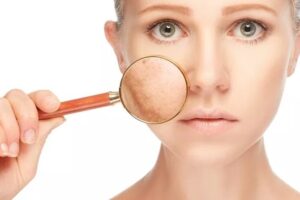 Tidak cukup tidur, Muka sembab, Kulit kusam